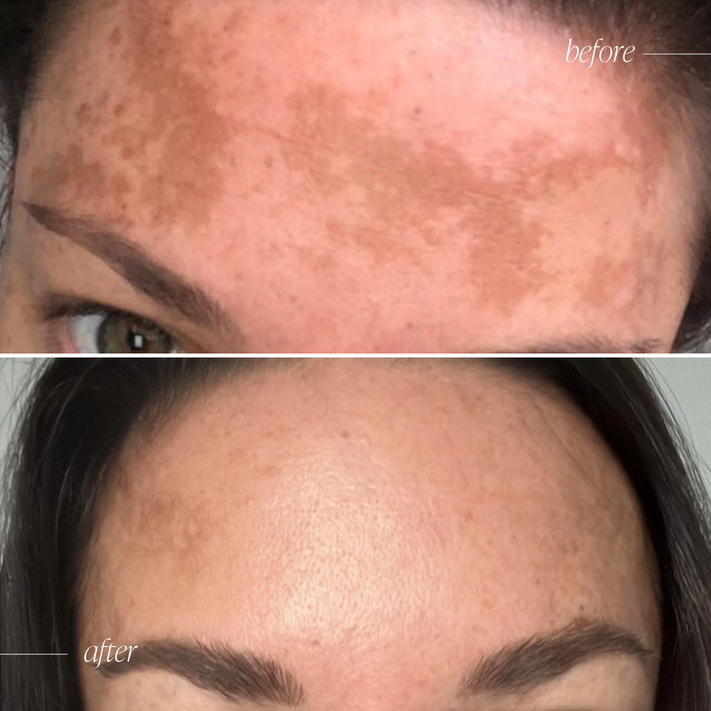 Before and after results 