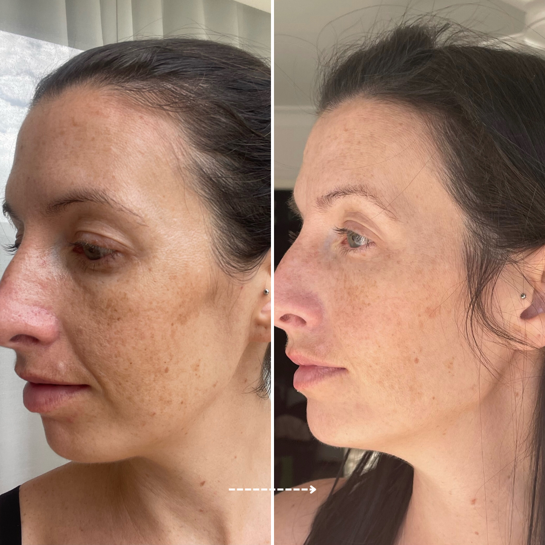 Viral Firming Peptide Moisturiser results in 28 days