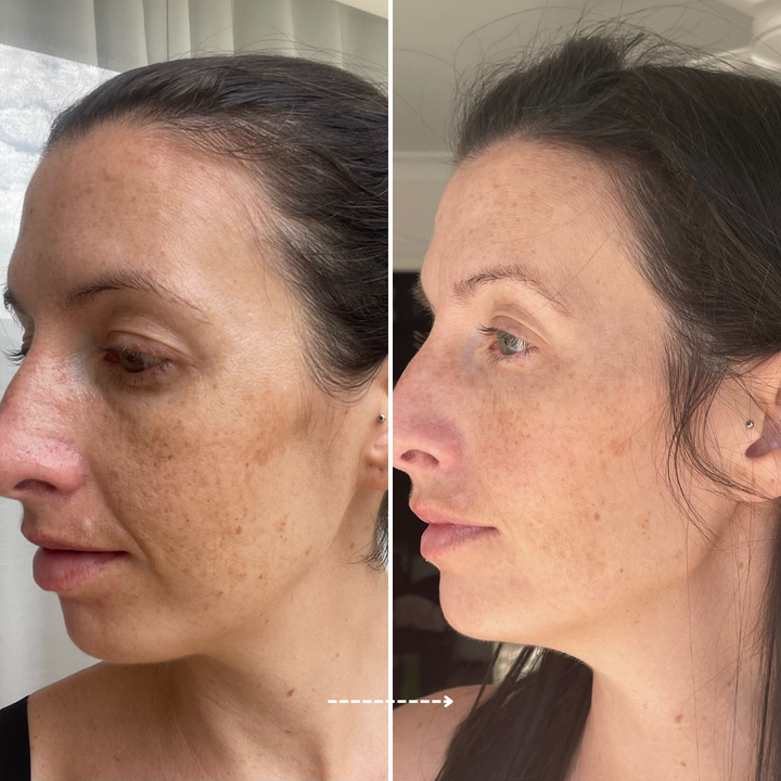 Viral Firming Peptide Moisturiser results in 28 days