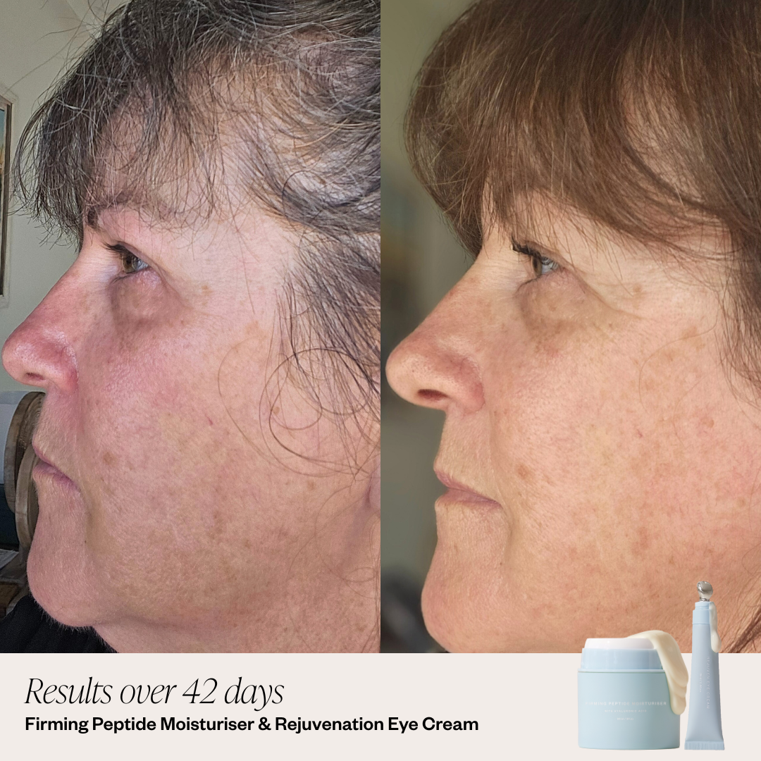 Eye Cream + Peptide Before and After