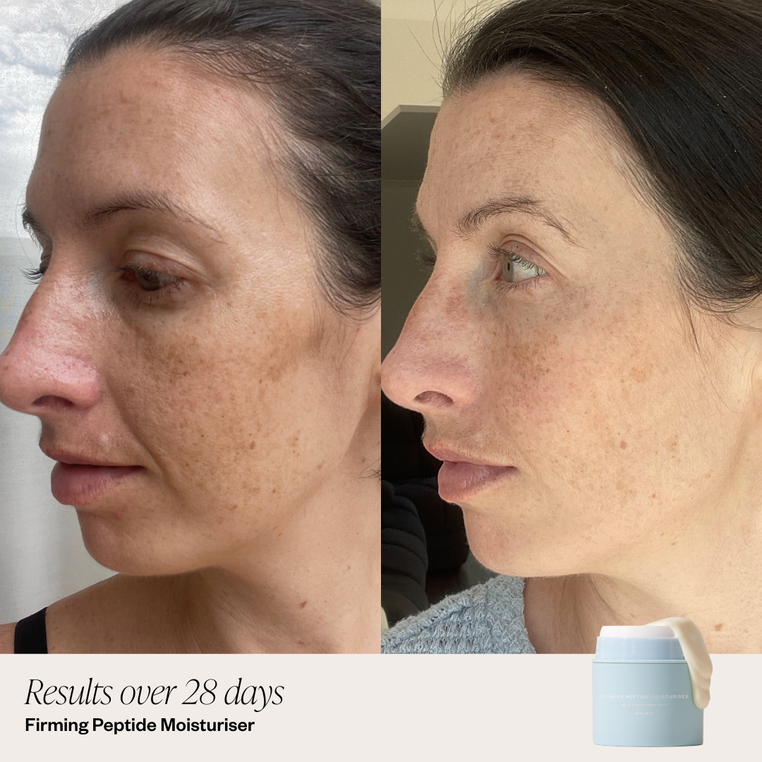 Firming Peptide Moisturiser B&A image