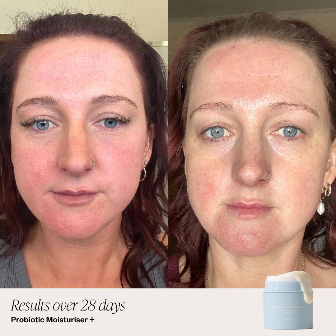 Probiotic Moisturiser +