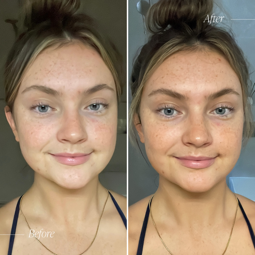 Bronzing Glow Drops before and after results