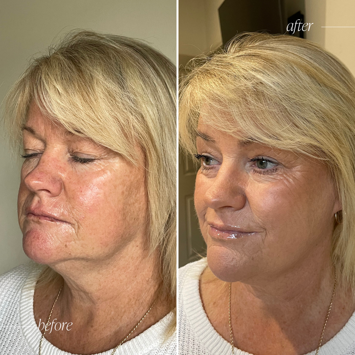 4 Step Matte Pro Finish Bundle - Normal/Dry/Mature Skin