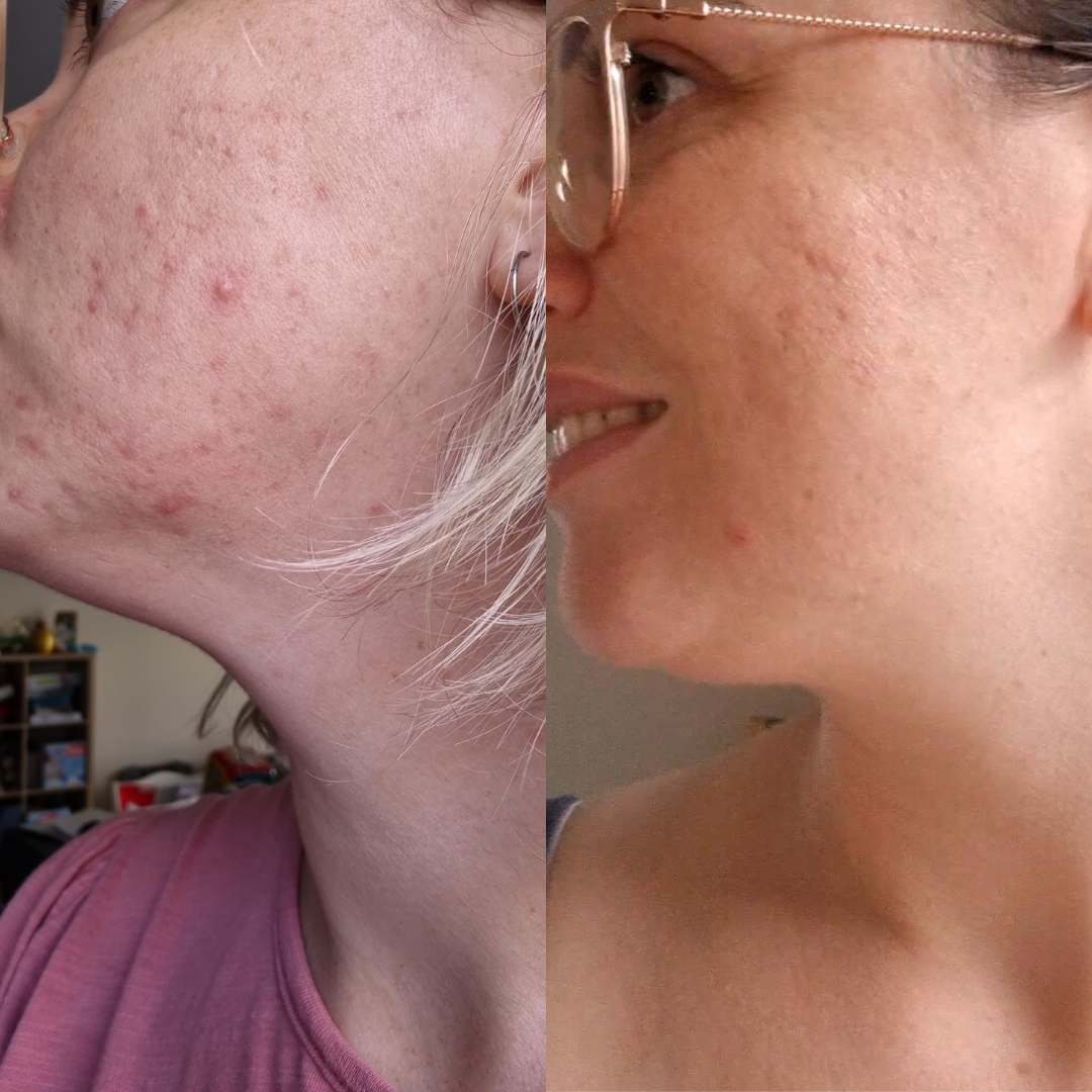 PRE-ORDER ITEM - Basics Skincare Bundle