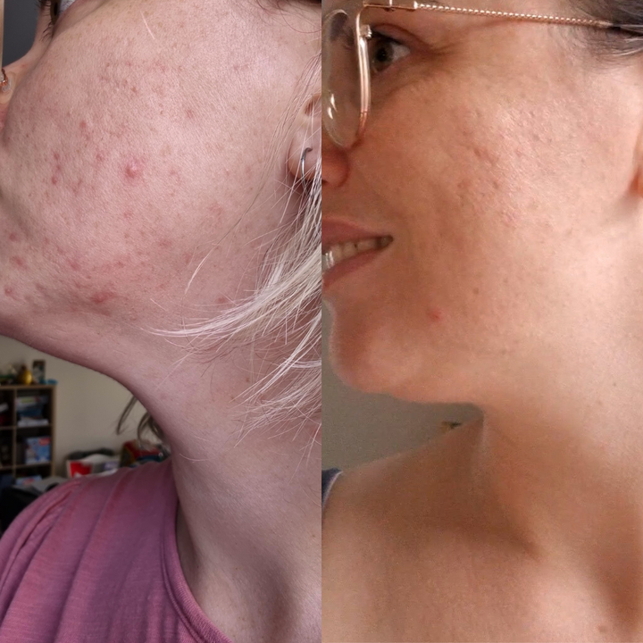PRE-ORDER ITEM - Basics Skincare Bundle