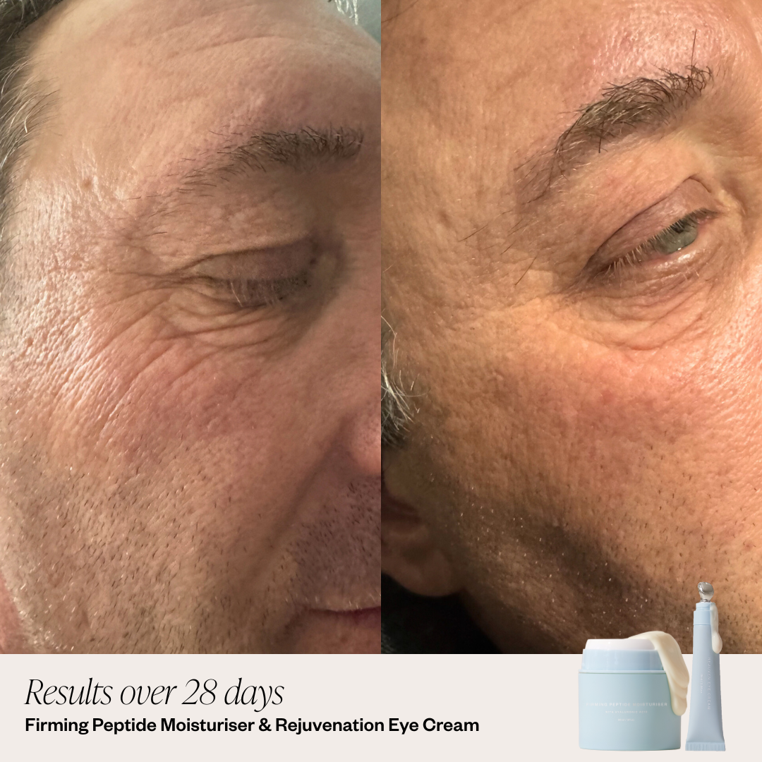 Male Before and after - peptide and eye cream