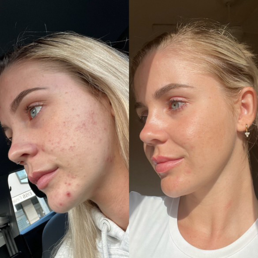 Probiotic Moisturiser + DUO
