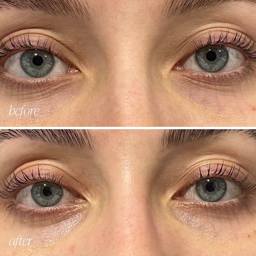 Eye Cream Results