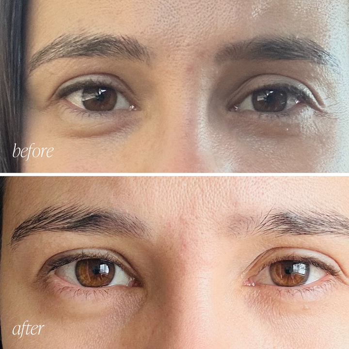 Skin before and after results 