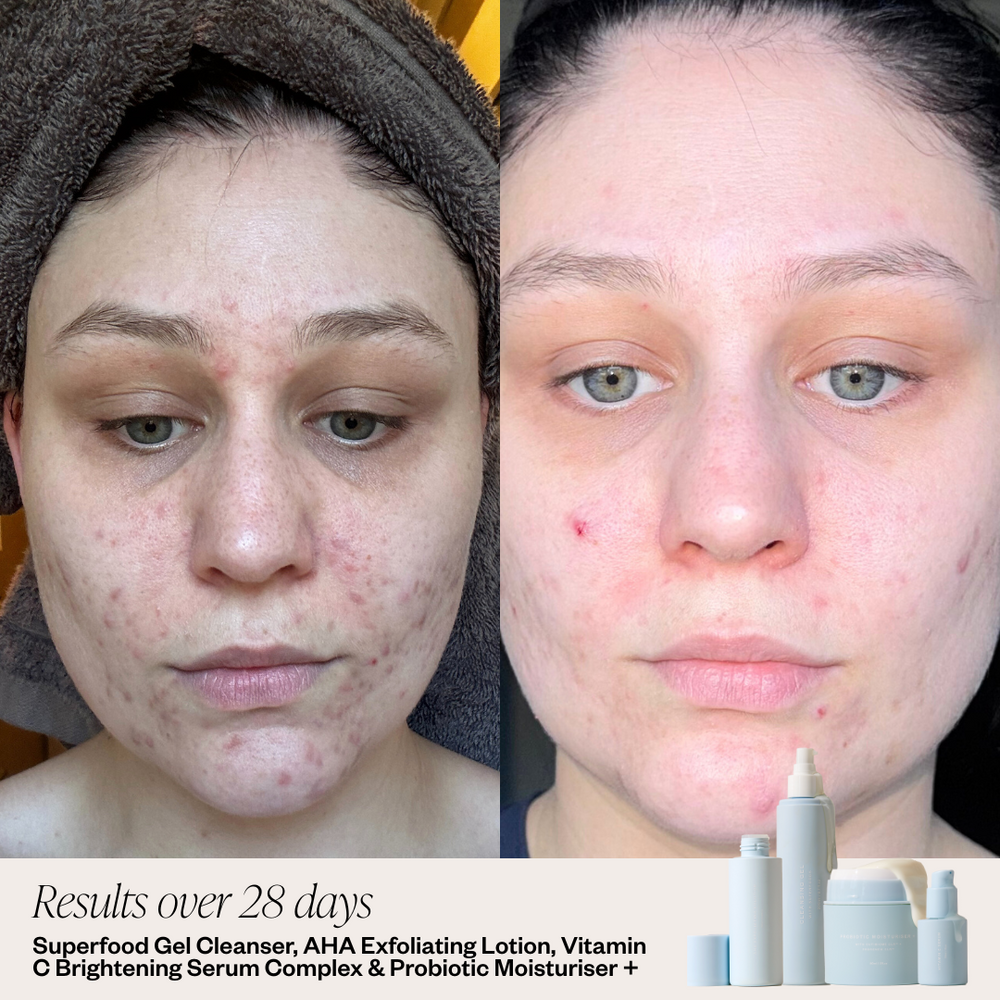 Skin result Photos
