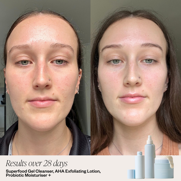 Skin before and after image 