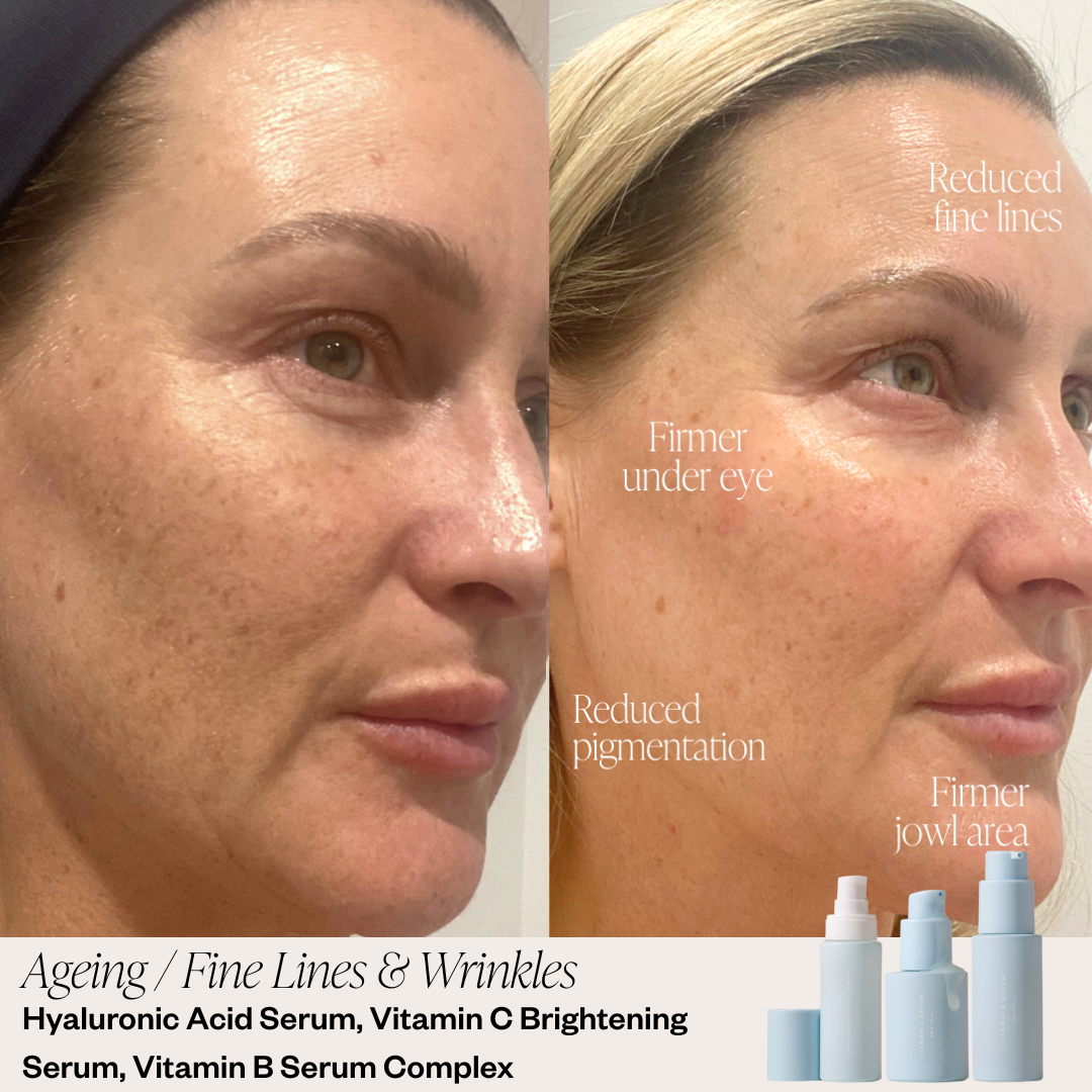 Skin before and after results 