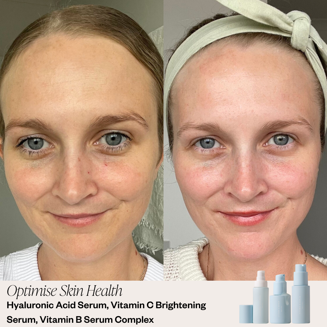 Skin before and after results 