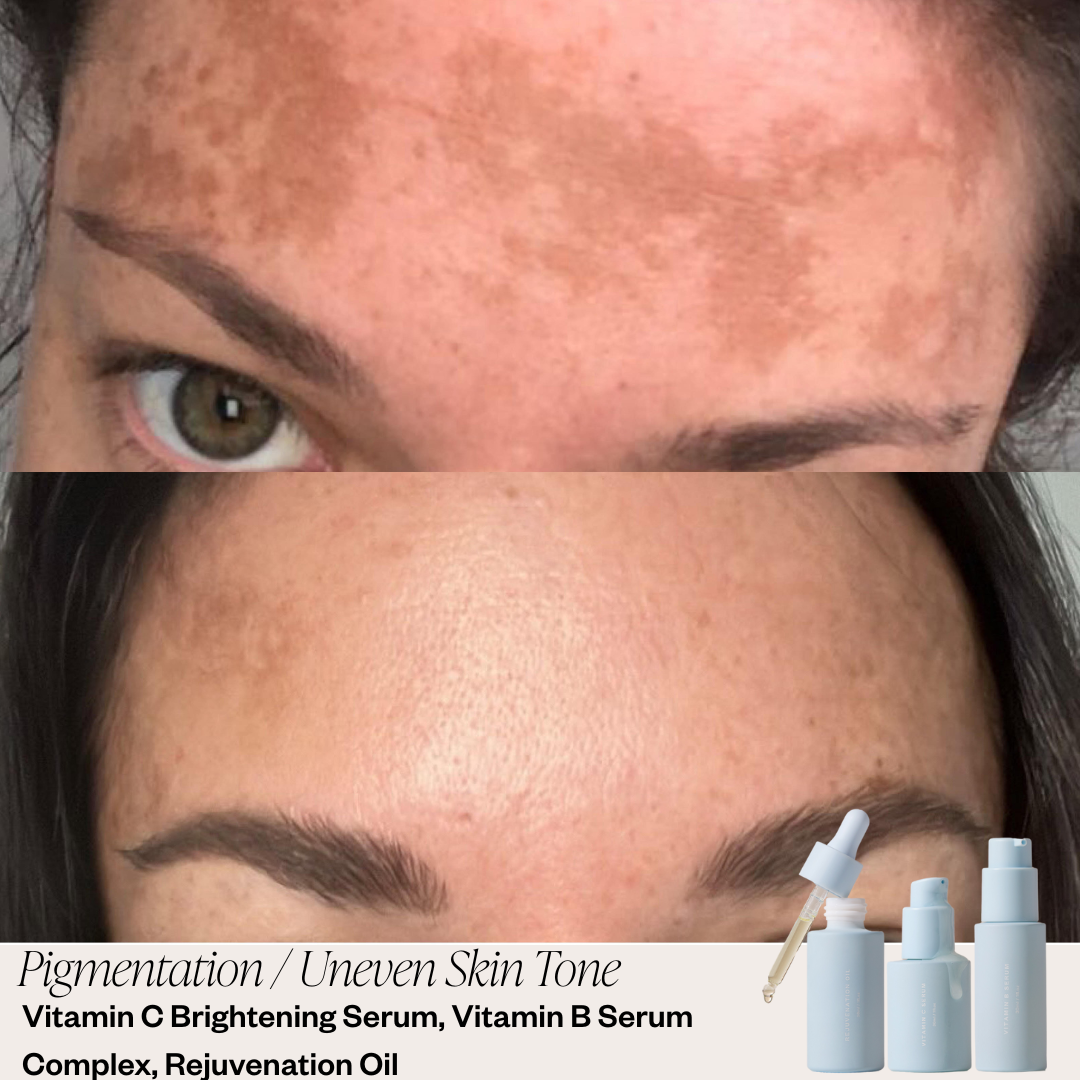 Skin before and after results