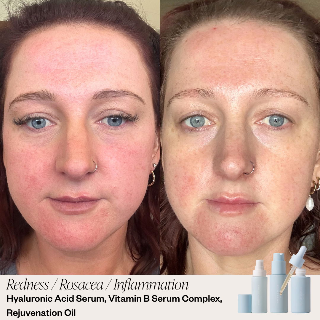 Skin before and after results 
