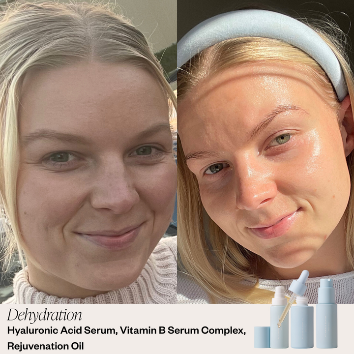 Skin before and after results 