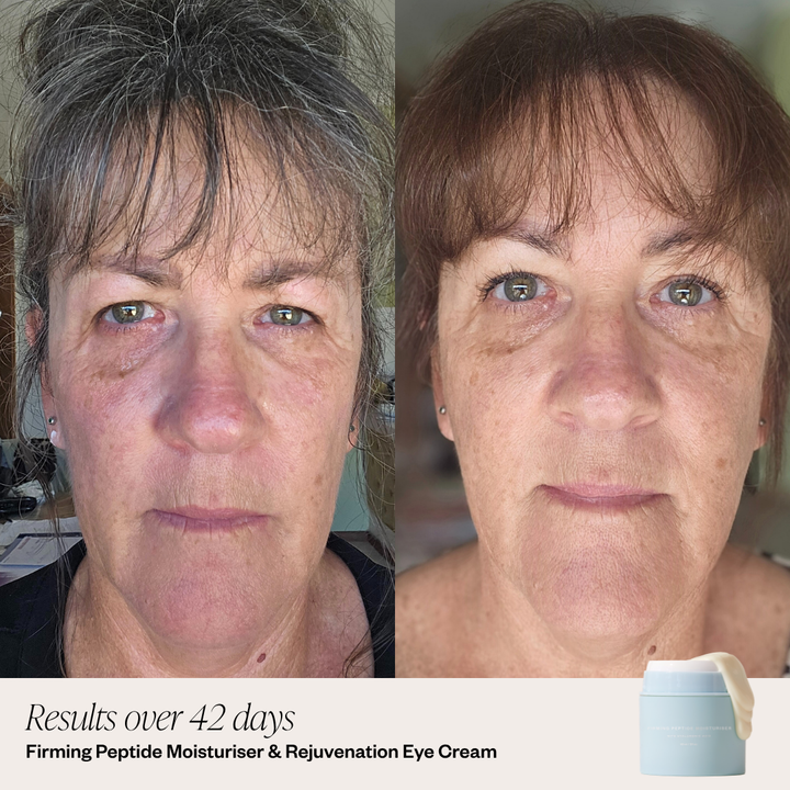 Before and after comparison of a woman's face with text about skincare results.