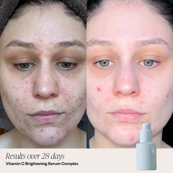 5 Step Brightening System