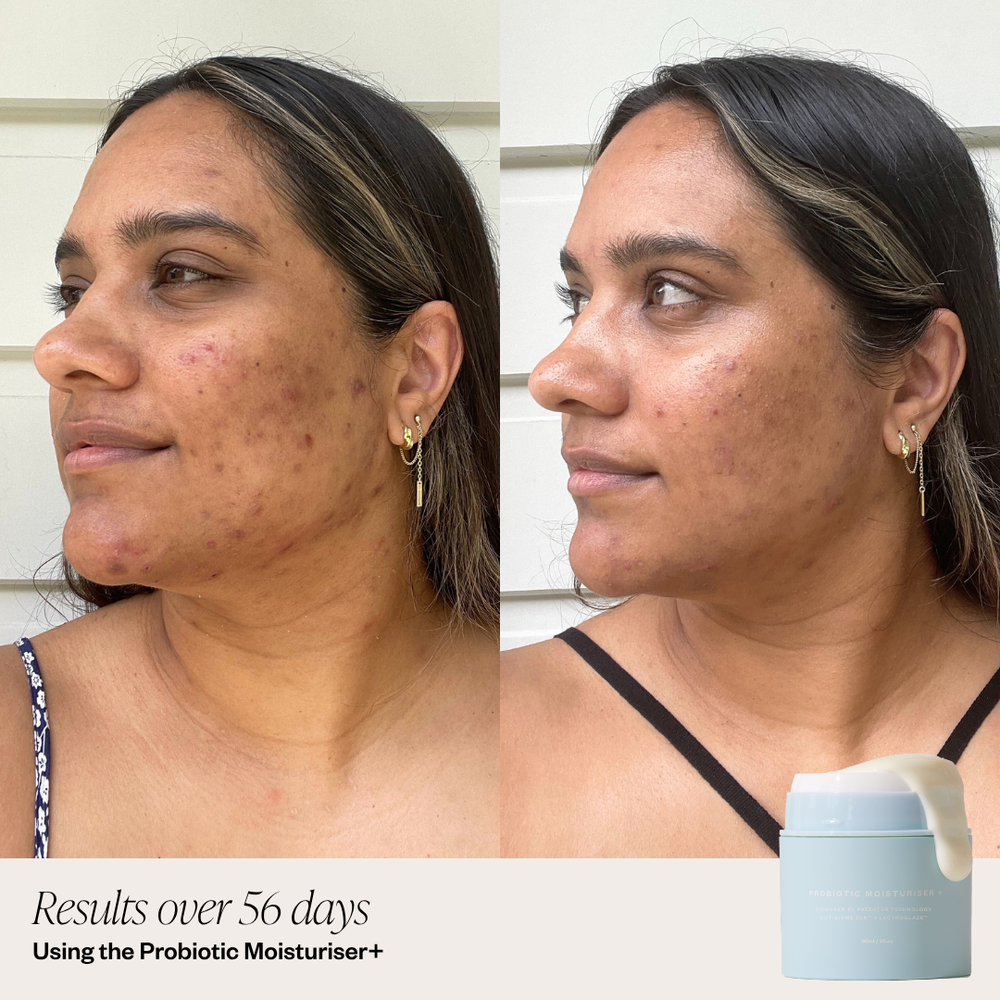 Probiotic Moisturiser powered by patented ingredients 