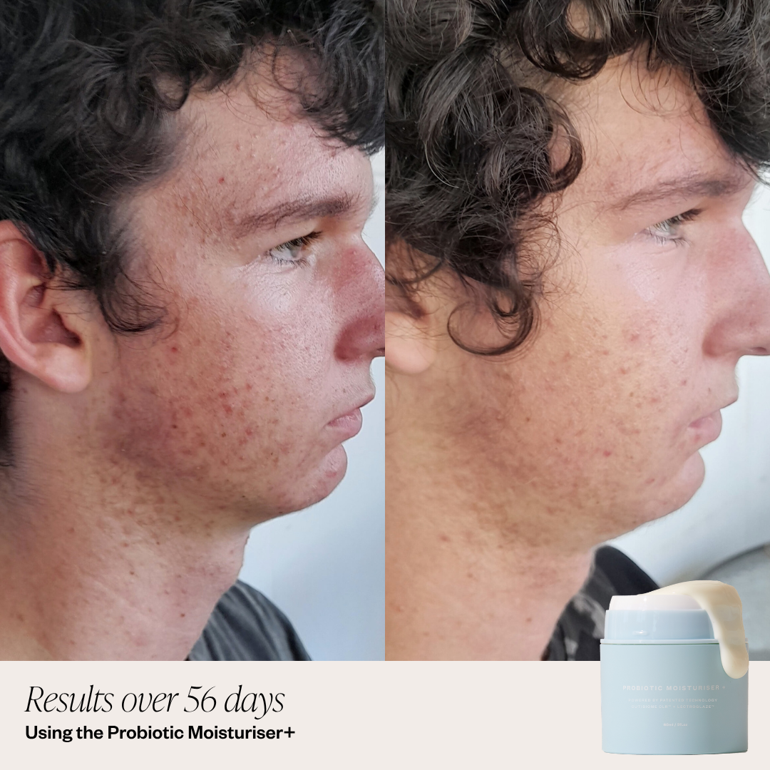 Probiotic Moisturiser + DUO