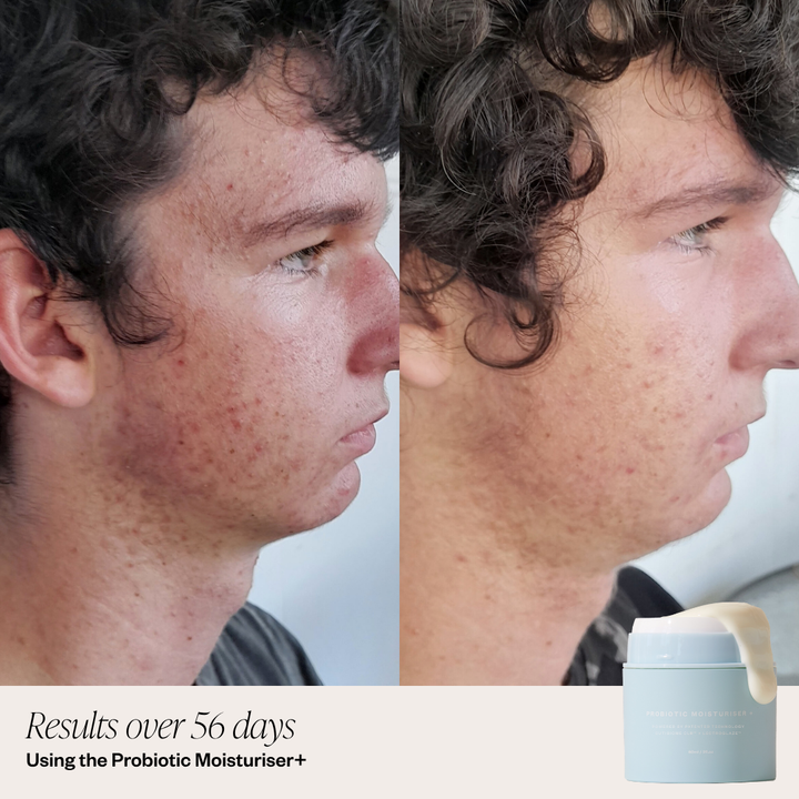 Probiotic Moisturiser + DUO