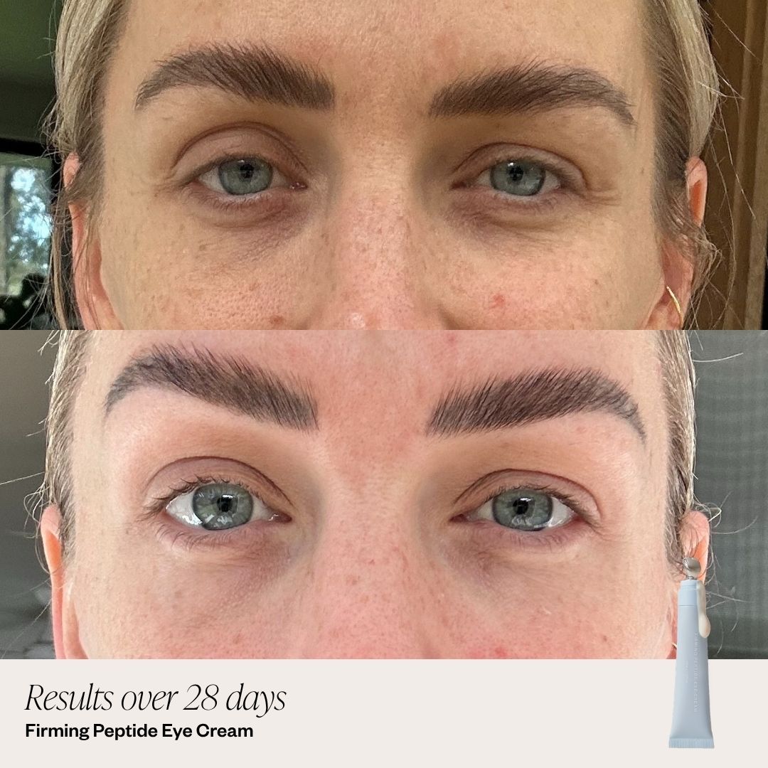 Before and after comparison of a person's eyes with text indicating results over 28 days for a firming peptide eye cream.