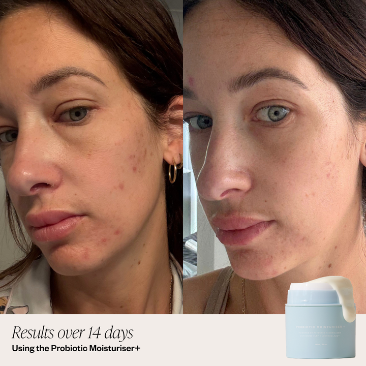 Probiotic Moisturiser powered by patented ingredients 