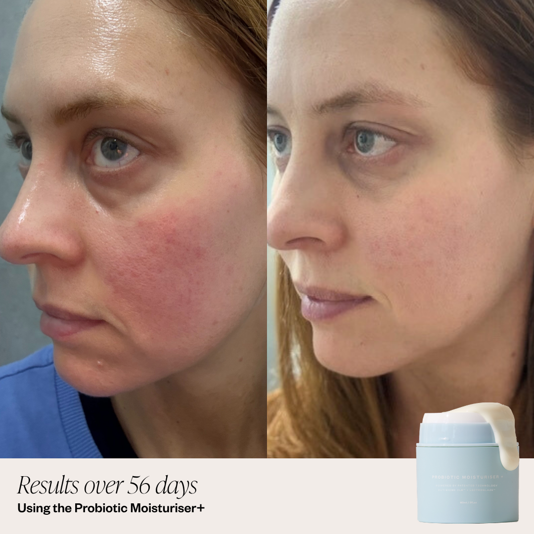 Probiotic Moisturiser + DUO