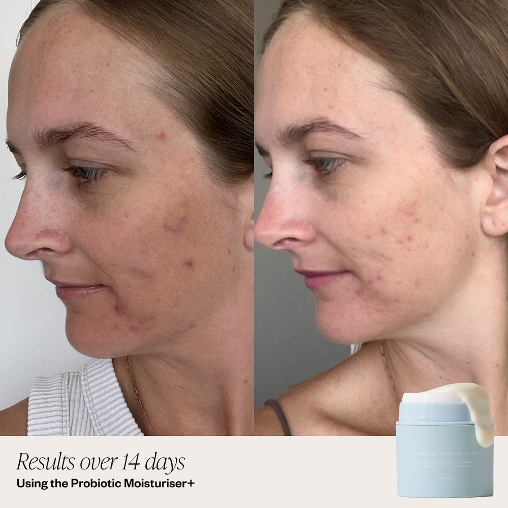 Probiotic Moisturiser powered by patented ingredients 