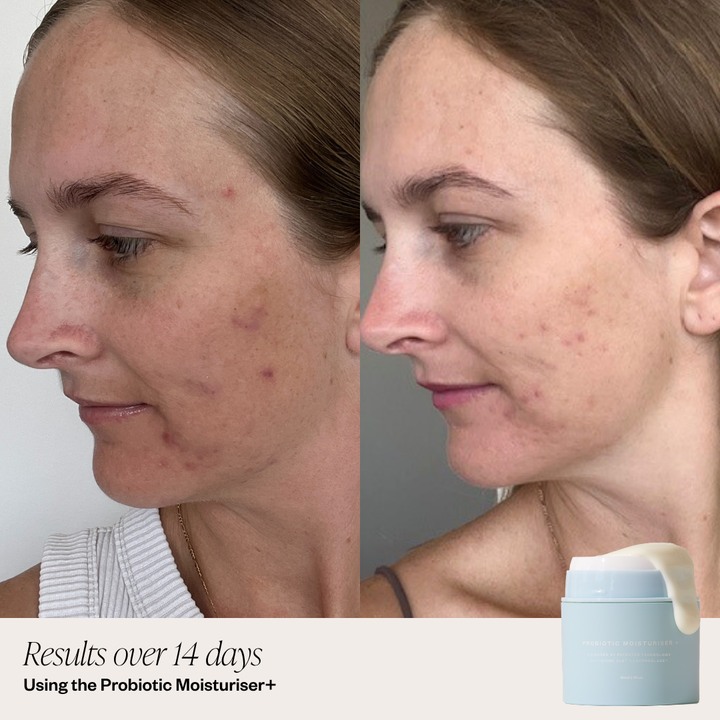 Probiotic Moisturiser + DUO
